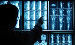 Radiology Practice Hack Affects Sensitive Data of 512,000 – Source: www.databreachtoday.com